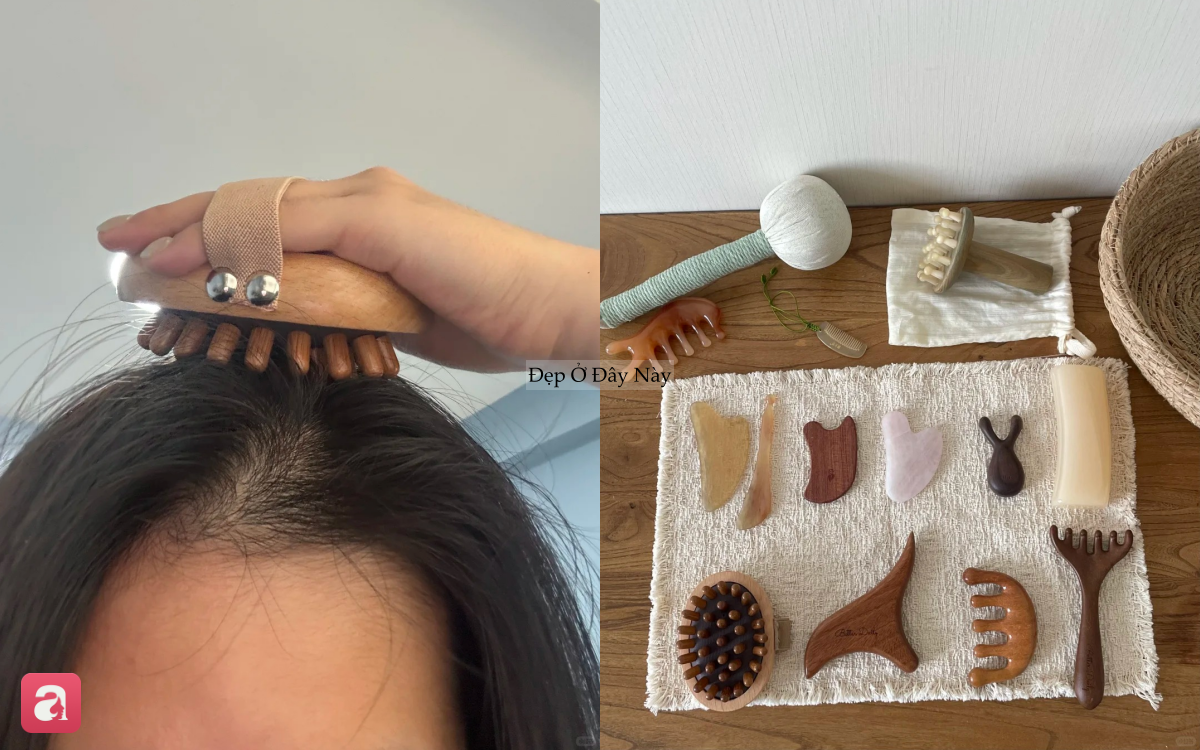 T&oacute;c rụng từng nắm vẫn 