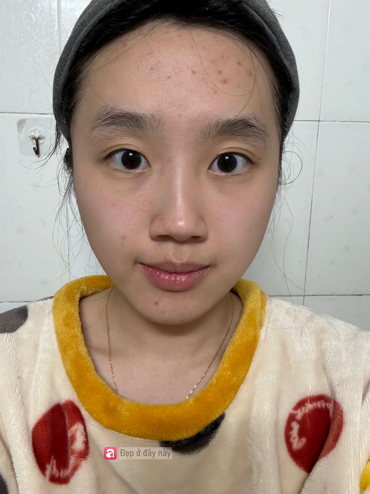 Tôi chỉ đắp nước muối sinh lý 3 phút mỗi lần, nhưng làn da lại thay đổi rõ sau 40 ngày- Ảnh 3.