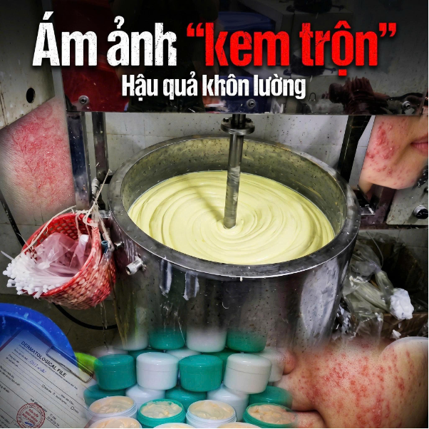 Phụ nữ 25+ n&ecirc;n chọn kem dưỡng collagen gi&uacute;p ngăn ngừa l&atilde;o h&oacute;a da - Ảnh 1.