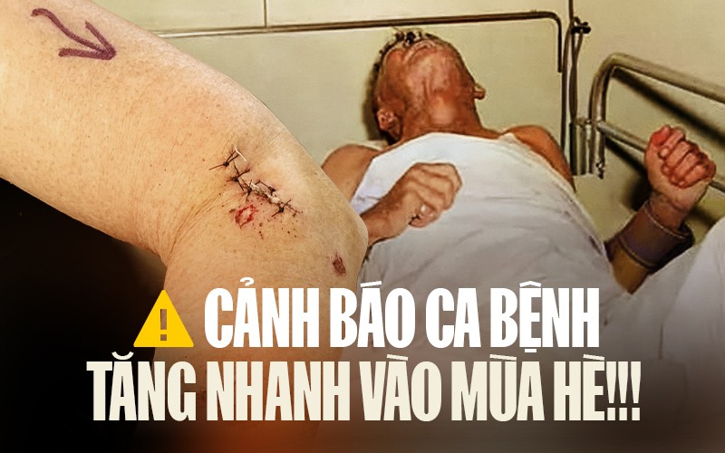 Vượt ngo&agrave;i khuyến nghị của WHO, nhiều nước lựa chọn c&aacute;ch tiếp cận theo FDA - Ảnh 1.