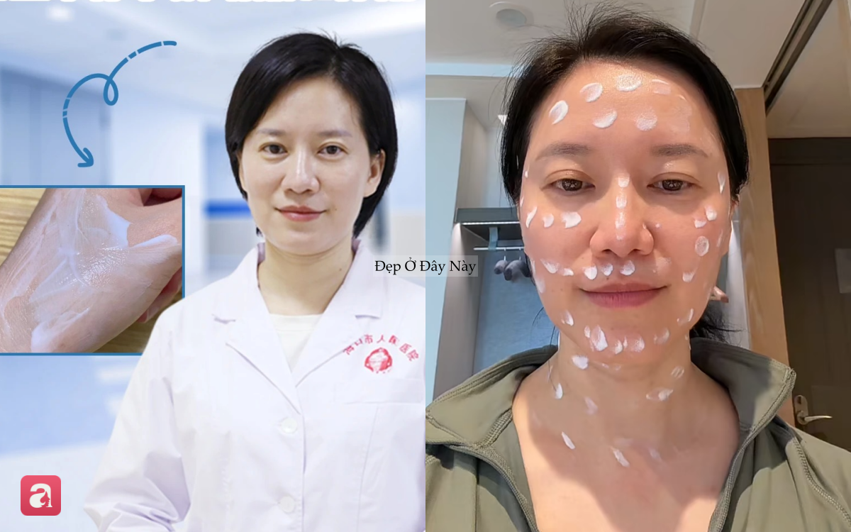 Tiến sĩ da liễu tiết lộ 5 c&aacute;ch giảm th&acirc;m n&aacute;m tại nh&agrave; nhiều người bỏ qua - Ảnh 3.