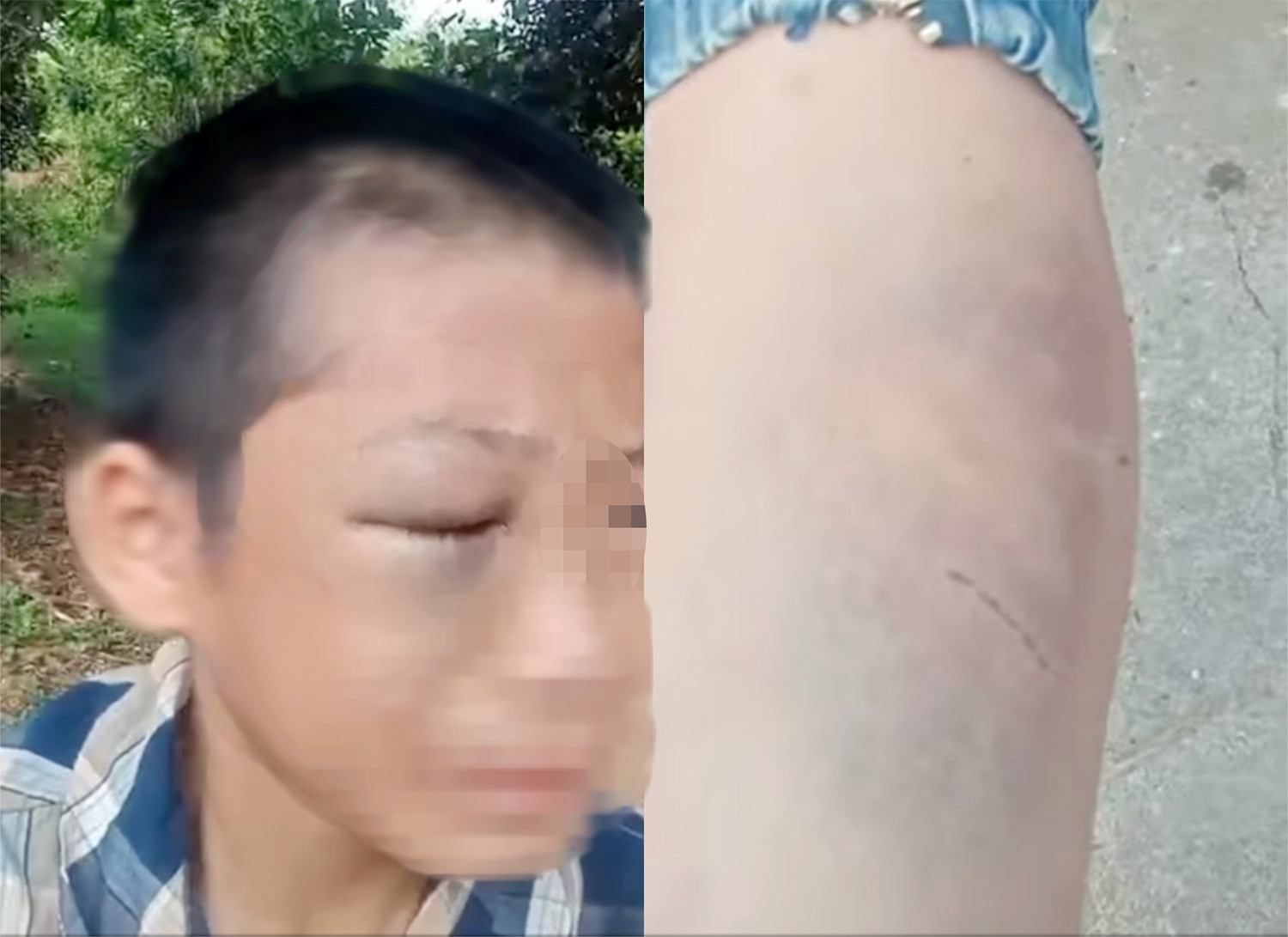 Clip b&eacute; trai mắt bầm t&iacute;m, kh&oacute;c k&ecirc;u cứu v&igrave; nhiều lần bị người th&acirc;n đ&aacute;nh đập - Ảnh 1.
