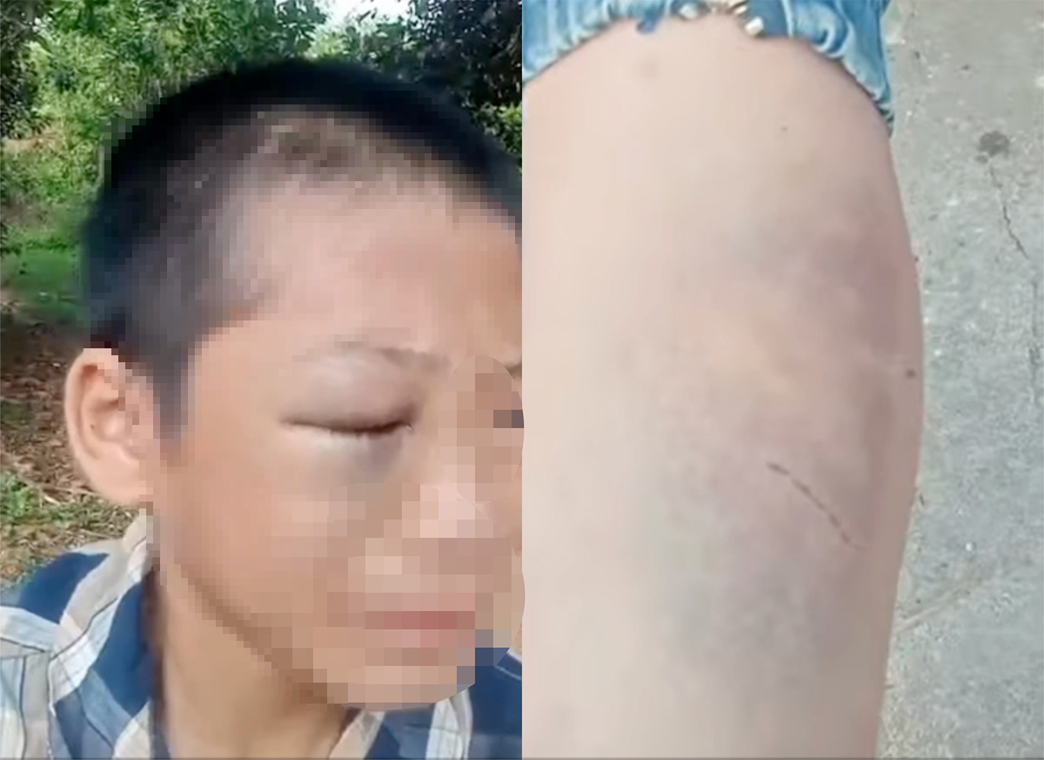 Th&ocirc;ng tin mới vụ ch&aacute;u b&eacute; 12 tuổi nghi bị bố mẹ kế đ&aacute;nh ở Nghệ An - Ảnh 3.
