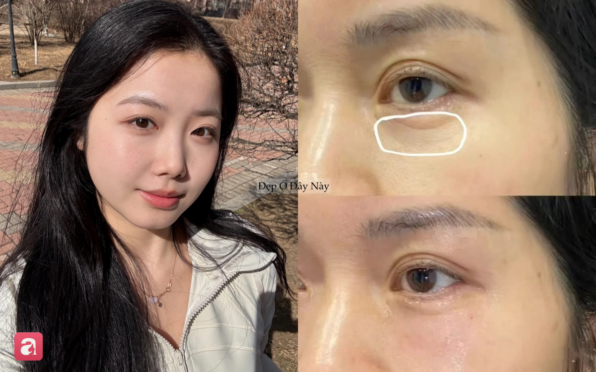 Lấp đầy nếp nhăn mắt với 5 lọ kem mắt chứa retinol l&agrave; 