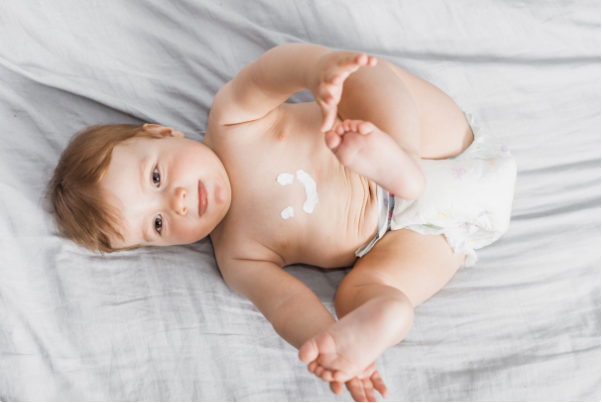 Da b&eacute; nhạy cảm v&agrave; h&agrave;nh tr&igrave;nh chọn bỉm: Mẹ cần biết những điều n&agrave;y - Ảnh 1.