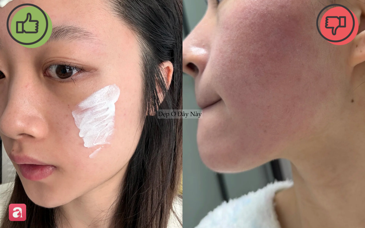 5 món skincare quan trọng bậc nhất trong mùa hè mà nhiều người thường lơ là bỏ qua - Ảnh 2.