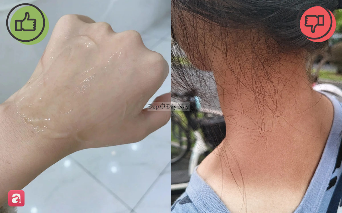 5 món skincare quan trọng bậc nhất trong mùa hè mà nhiều người thường lơ là bỏ qua - Ảnh 6.