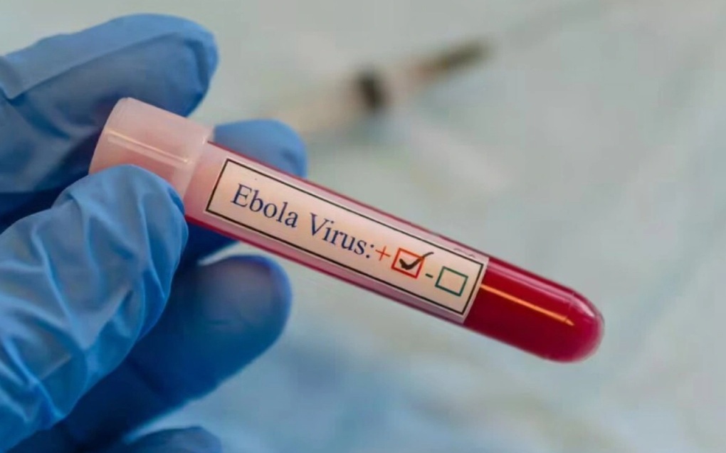TPHCM tăng cường gi&aacute;m s&aacute;t cửa khẩu, chủ động ph&ograve;ng nguy cơ dịch bệnh Ebola x&acirc;m nhập - Ảnh 2.