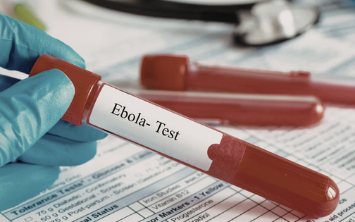 Ebola c&oacute; nguy cơ lan rộng, Bộ Y tế khuyến c&aacute;o hạn chế đến v&ugrave;ng dịch - Ảnh 1.