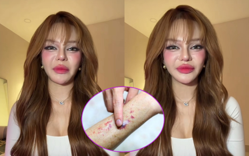 TikToker Đan Thy th&ocirc;ng b&aacute;o mắc ung thư m&aacute;u ở tuổi 23: Ung thư m&aacute;u c&oacute; chữa được kh&ocirc;ng? - Ảnh 3.