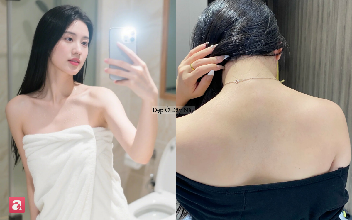 D&agrave;nh cho người mụn lưng: 5 sữa tắm 