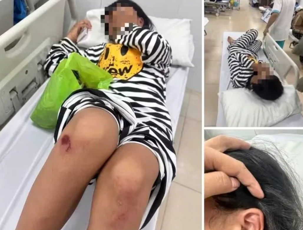 Gia đ&igrave;nh tr&igrave;nh b&aacute;o c&ocirc;ng an vụ nữ sinh lớp 6 bị đ&aacute;nh v&agrave; nhục mạ t&agrave;n nhẫn - Ảnh 2.