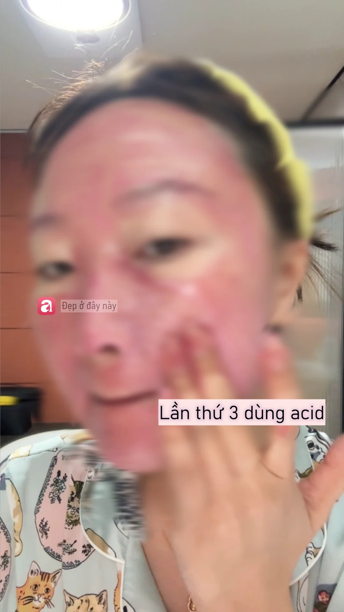 T&ocirc;i d&ugrave;ng acid nồng độ 30% lần thứ 3: Da vẫn b&oacute;ng mịn nhưng đỡ đỏ r&aacute;t hơn hẳn - Ảnh 3.
