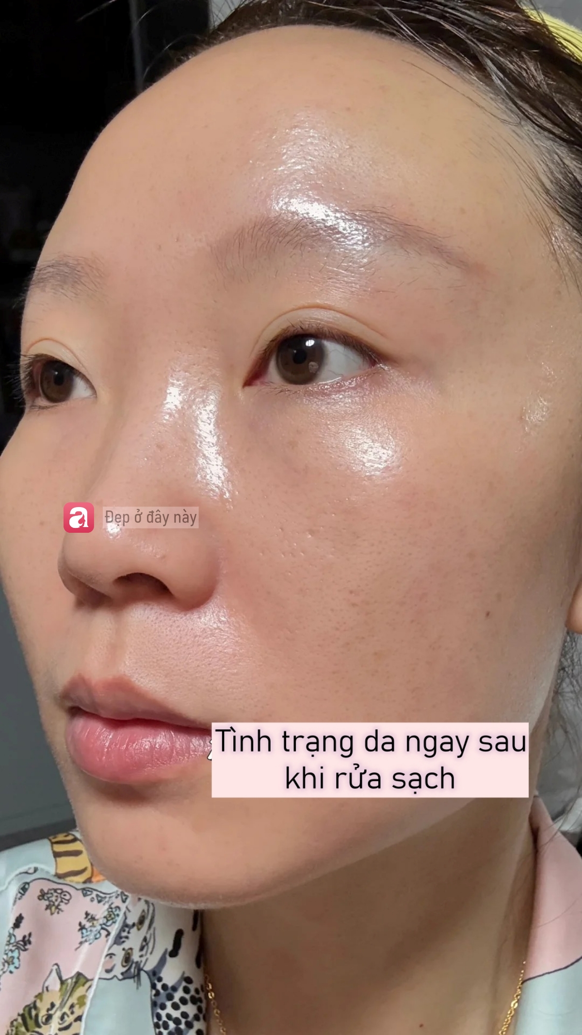 T&ocirc;i d&ugrave;ng acid nồng độ 30% lần thứ 3: Da vẫn b&oacute;ng mịn nhưng đỡ đỏ r&aacute;t hơn hẳn - Ảnh 4.