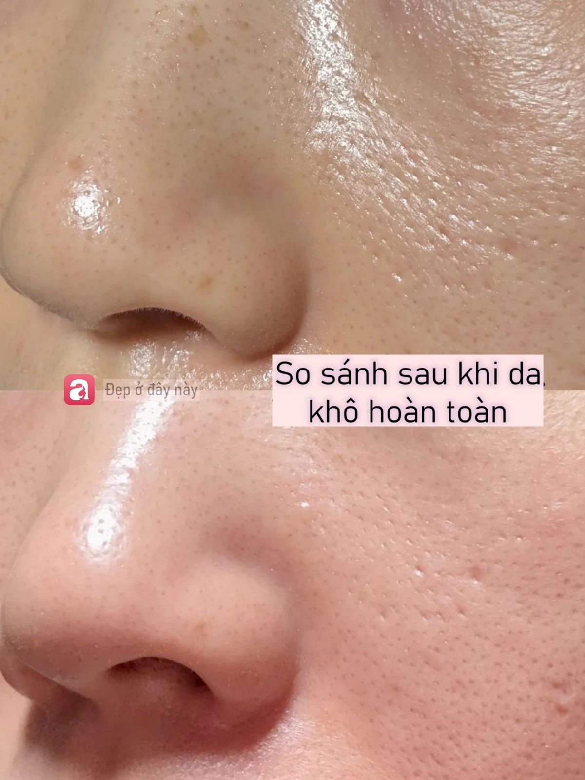 T&ocirc;i d&ugrave;ng acid nồng độ 30% lần thứ 3: Da vẫn b&oacute;ng mịn nhưng đỡ đỏ r&aacute;t hơn hẳn - Ảnh 6.