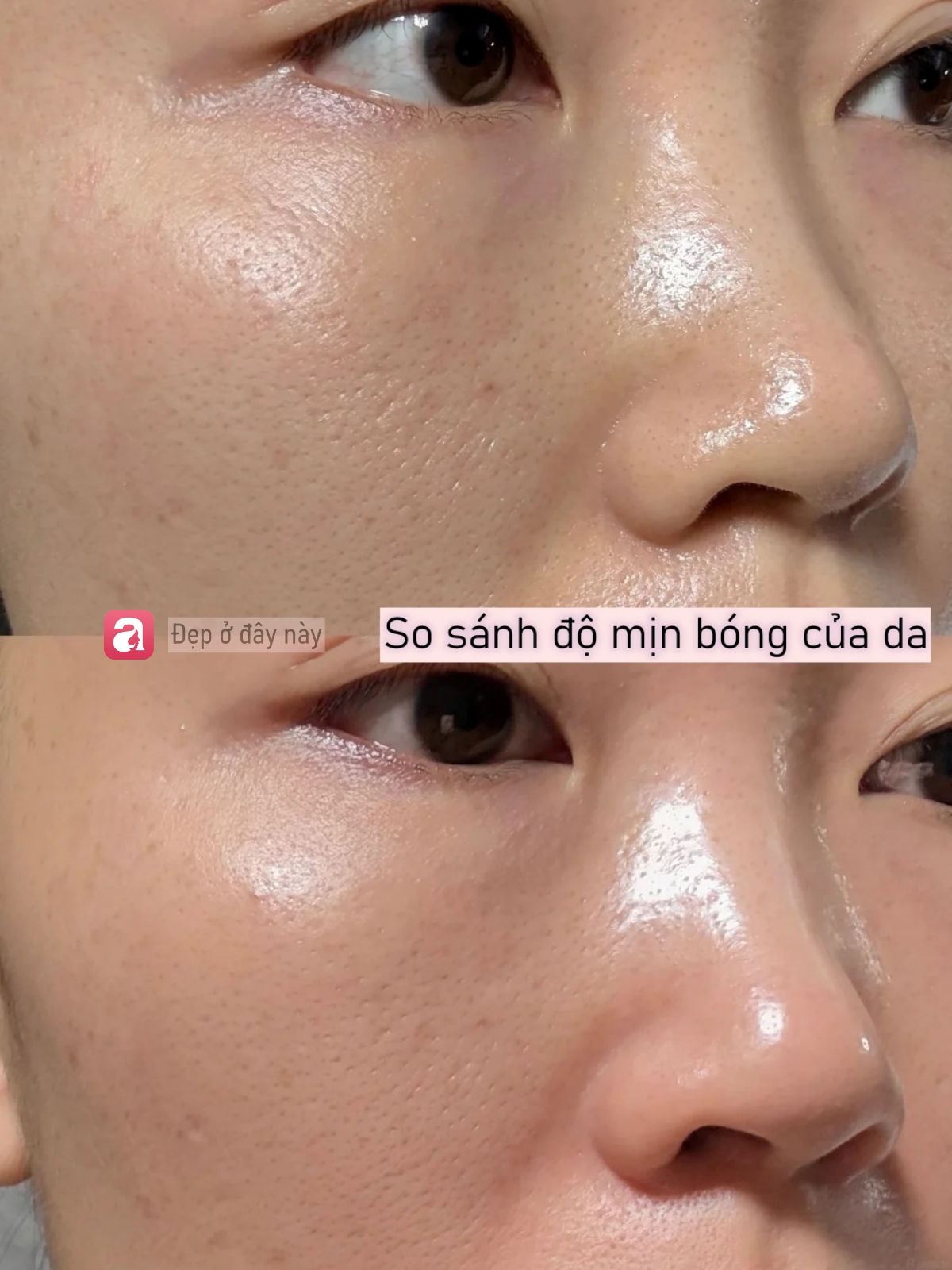T&ocirc;i d&ugrave;ng acid nồng độ 30% lần thứ 3: Da vẫn b&oacute;ng mịn nhưng đỡ đỏ r&aacute;t hơn hẳn - Ảnh 5.