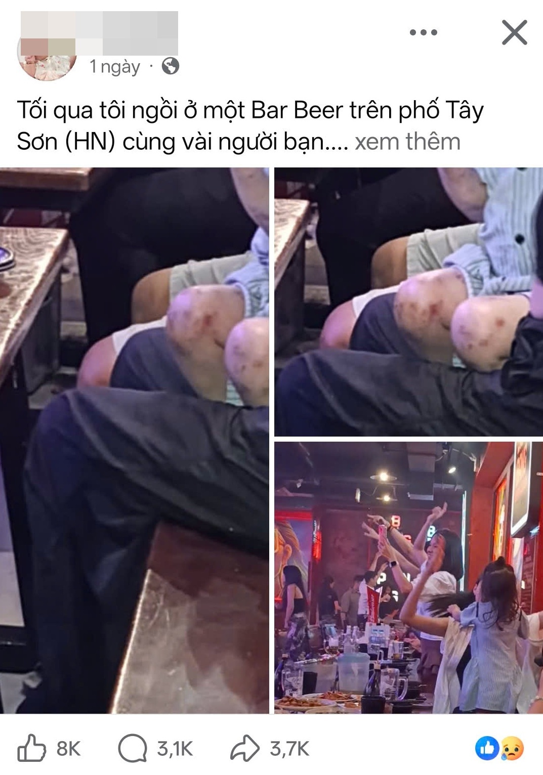C&ocirc;ng an H&agrave; Nội x&aacute;c minh vụ b&eacute; g&aacute;i 3 tuổi nghi bị bạo h&agrave;nh tại qu&aacute;n bia - Ảnh 2.
