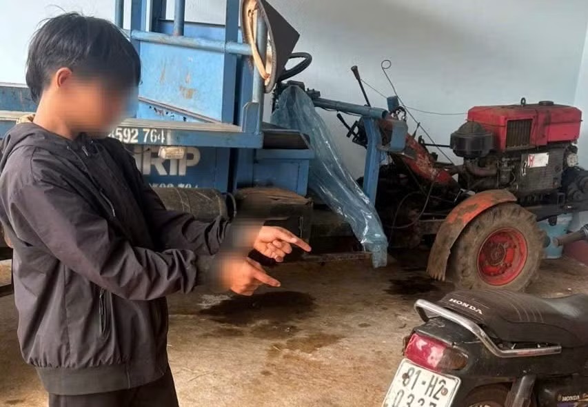 Thiếu ni&ecirc;n cướp giật 1 , 5 triệu đồng từ người khuyết tật tại gia Lai - Ảnh 1.