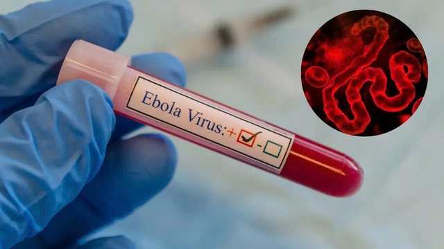 WHO: Ng&agrave;nh y tế chủ động, sẵn s&agrave;ng hệ thống v&agrave; năng lực ứng ph&oacute; Ebola- Ảnh 2.