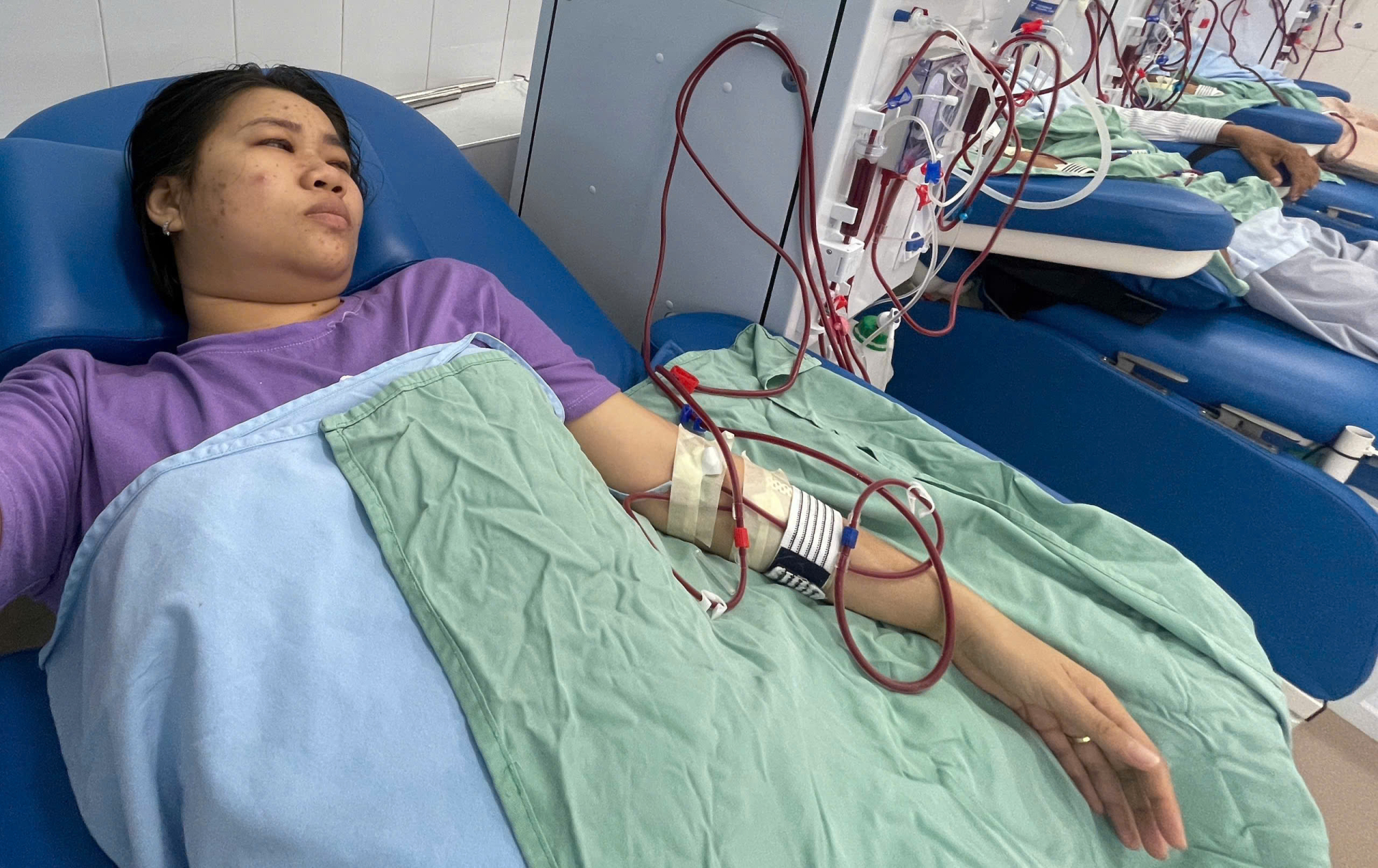 Nỗi đau chồng chất của mẹ m&ugrave; l&ograve;a v&agrave; con trai ung thư Tại Huế - Ảnh 1.