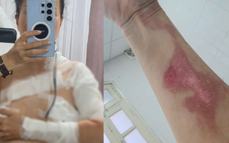 5 loại hạt lẽ ra n&ecirc;n BỊ CẤM từ l&acirc;u: Nhiều người vẫn đang ăn mỗi ng&agrave;y - Ảnh 4.