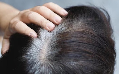 T&oacute;c bạc sớm l&agrave; do thiếu dưỡng chất, bổ sung 7 thực phẩm v&agrave;ng sẽ gi&uacute;p t&oacute;c &ldquo;hồi sinh&rdquo; - Ảnh 2.