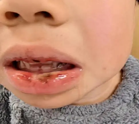 Trẻ uống nhầm dung dịch thông cống: Bác sĩ cảnh báo : Sơ cứu sai còn nguy hiểm hơn - Ảnh 1.