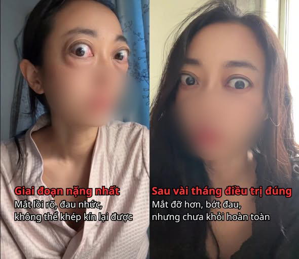 Nhìn đôi mắt