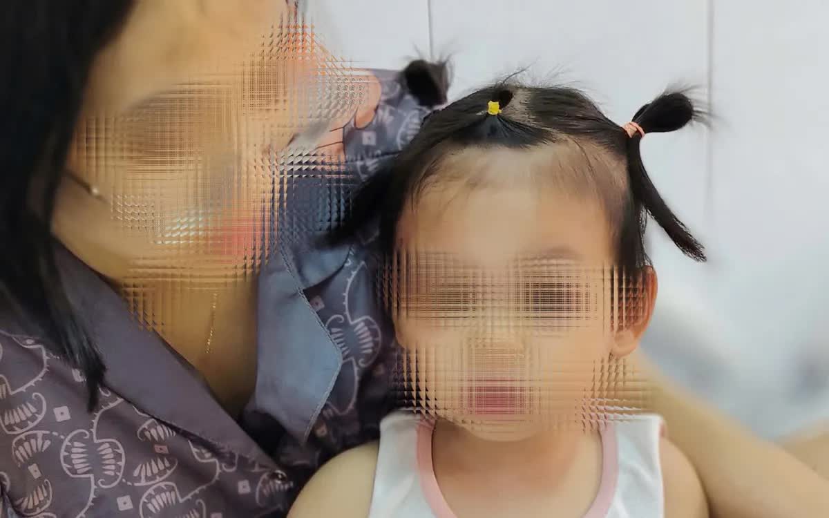 Cấp cứu kịp thời cho b&eacute; g&aacute;i bị ch&oacute; cắn , bảo to&agrave;n khu&ocirc;n mặt - Ảnh 1.