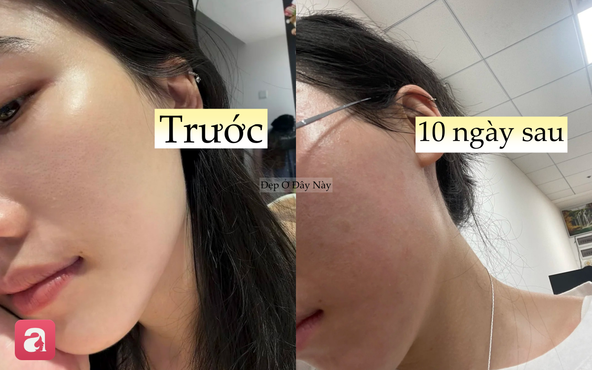 Thử thách không rửa mặt trong 10 ngày, cô nàng nhận kết quả 