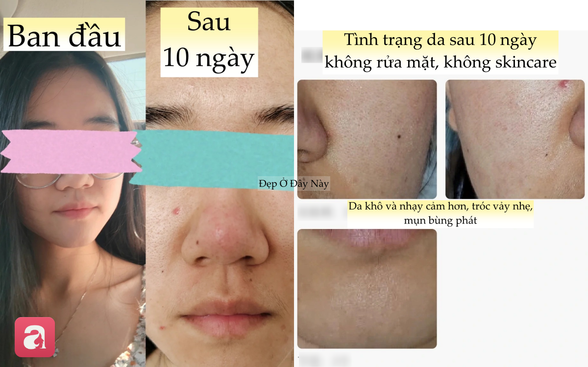 Thử thách không rửa mặt trong 10 ngày, cô nàng nhận kết quả 