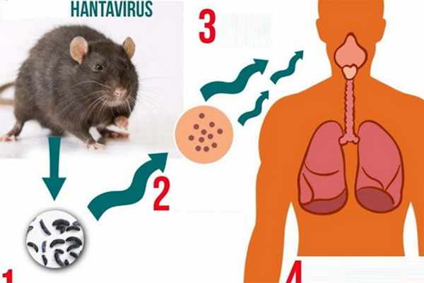 Bộ Y tế cảnh b&aacute;o khẩn về bệnh do virus Hanta khiến 3 người tử vong tr&ecirc;n t&agrave;u du lịch, Việt Nam chưa ghi nhận ca bệnh - Ảnh 2.