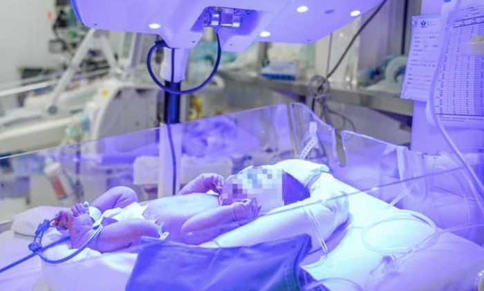 Kỳ t&iacute;ch cứu b&eacute; sơ sinh nh&oacute;m m&aacute;u cực hiếm Tại bệnh viện nhi Trung ương - Ảnh 1.