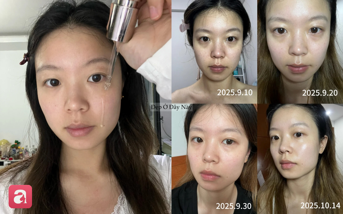 1 th&aacute;ng d&ugrave;ng serum vitamin C, l&agrave;n da của n&agrave;ng blogger như 