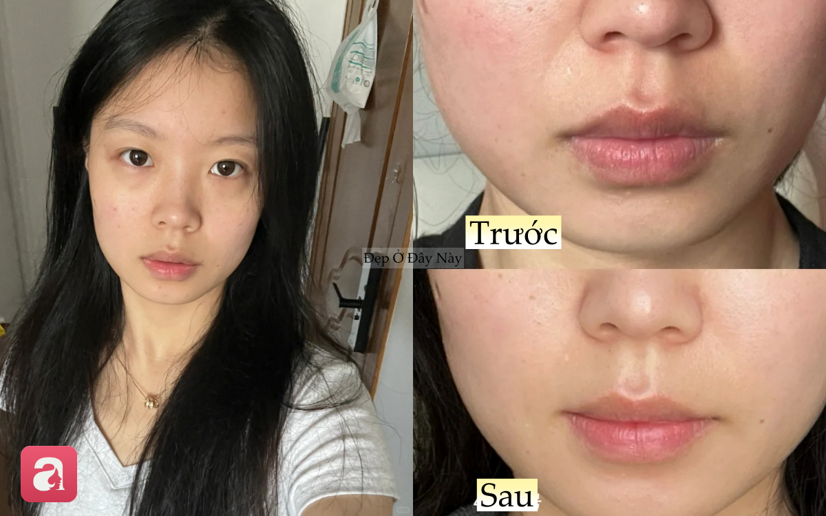 1 th&aacute;ng d&ugrave;ng serum vitamin C, l&agrave;n da của n&agrave;ng blogger như 