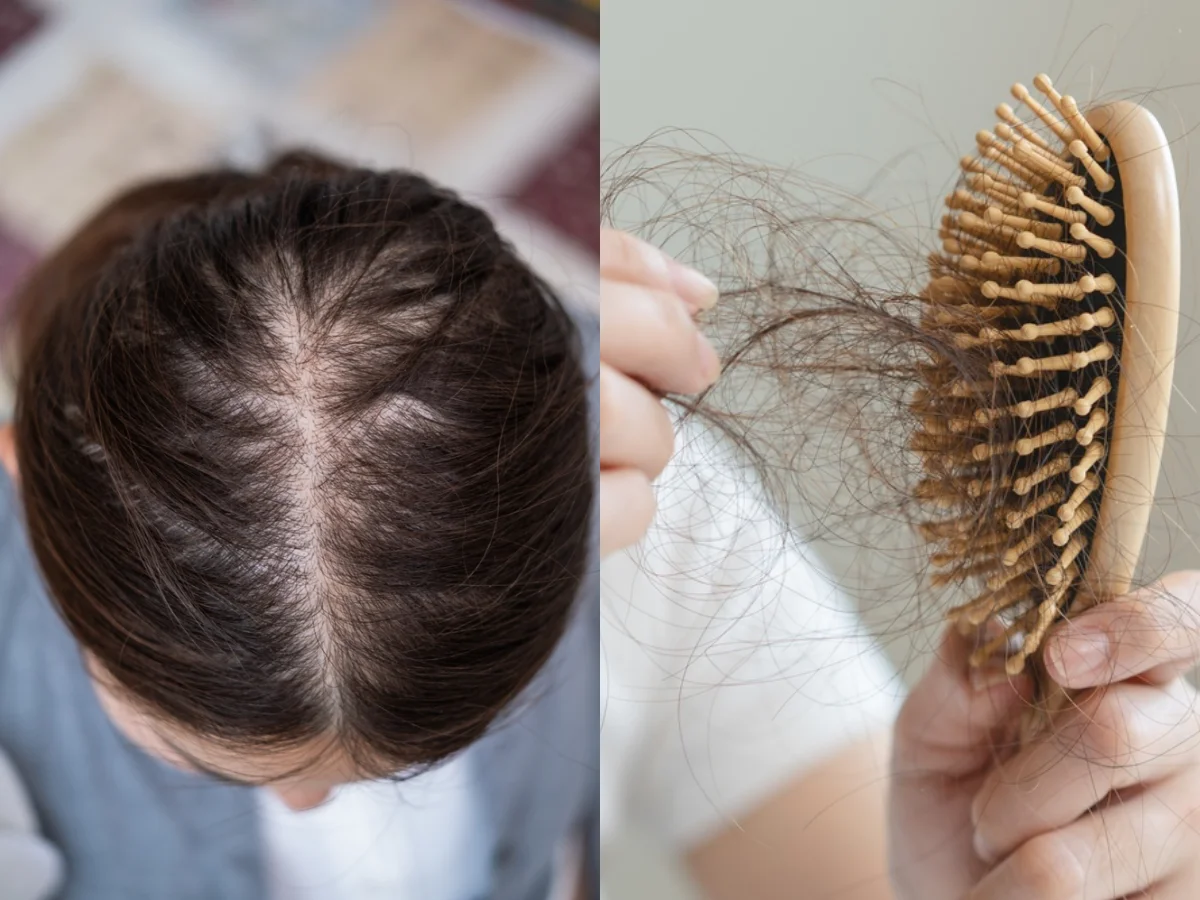 Đừng chỉ ăn trứng luộc để ngừa t&oacute;c rụng! 