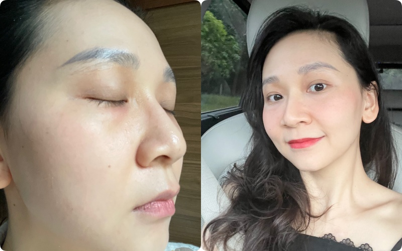 Kh&ocirc;ng d&ugrave;ng retinol, đ&acirc;y l&agrave; l&agrave;n da tuổi 36 của t&ocirc;i khi d&ugrave;ng 3 loại serum n&agrave;y - Ảnh 3.