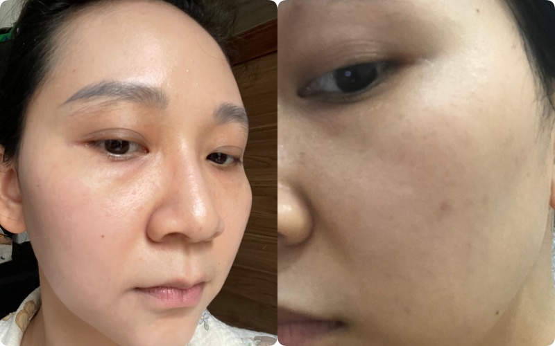 Kh&ocirc;ng d&ugrave;ng retinol, đ&acirc;y l&agrave; l&agrave;n da tuổi 36 của t&ocirc;i khi d&ugrave;ng 3 loại serum n&agrave;y - Ảnh 1.
