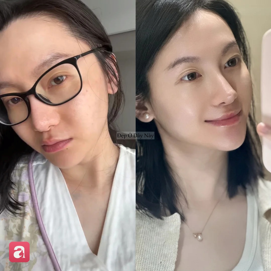Muốn da đẹp l&acirc;u d&agrave;i, t&ocirc;i đ&atilde; ngừng l&agrave;m một điều m&agrave; nhiều người vẫn đang cố gắng - Ảnh 2.