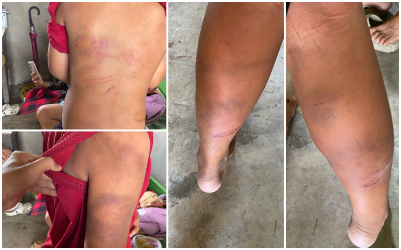 Vụ b&eacute; trai 10 tuổi bị bạo h&agrave;nh: Lời khai g&acirc;y sốc từ bố đẻ Tại Nghệ An - Ảnh 2.