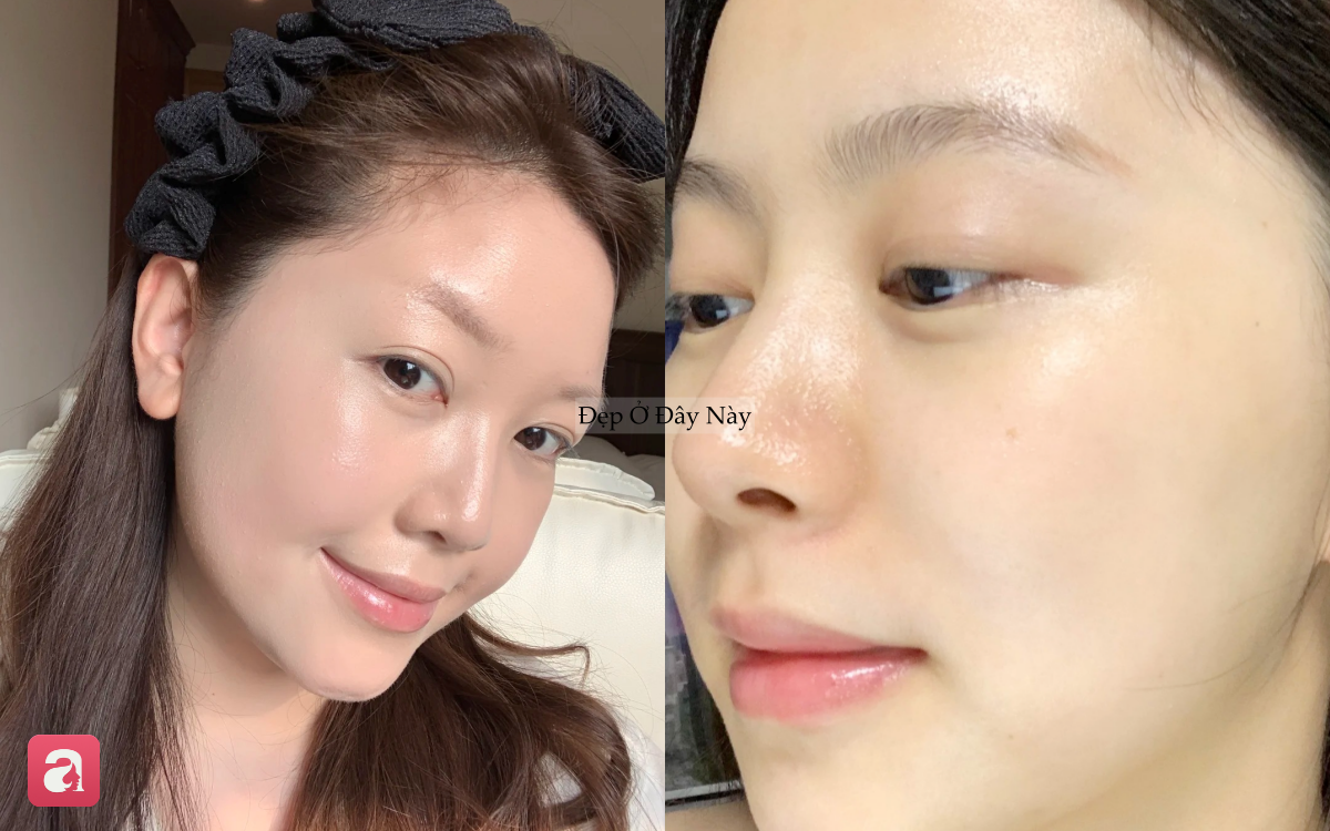 5 lọ serum 