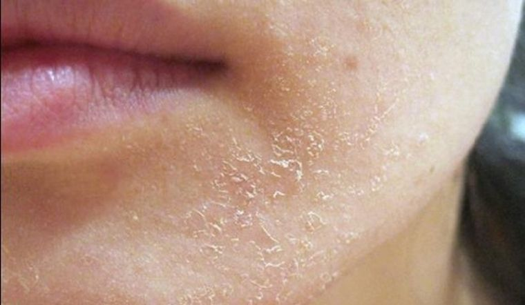 Kem chống nắng cho da mụn đến da dầu, da khô...: Đây là những sản phẩm được chuyên gia da liễu Hàn Quốc đánh giá cao - Ảnh 3.