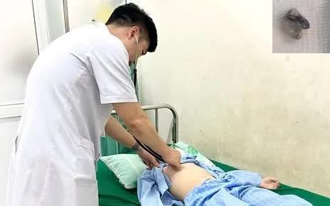 Nguy hiểm khi nhổ răng tại nh&agrave; cho trẻ: C&acirc;u chuyện b&eacute; trai 9 tuổi nguy kịch - Ảnh 1.