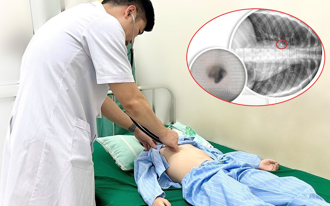 Người đ&agrave;n &ocirc;ng suy h&ocirc; hấp, co giật to&agrave;n th&acirc;n phải điều trị cấp cứu suốt 1 th&aacute;ng sau khi xỉa răng - Ảnh 3.