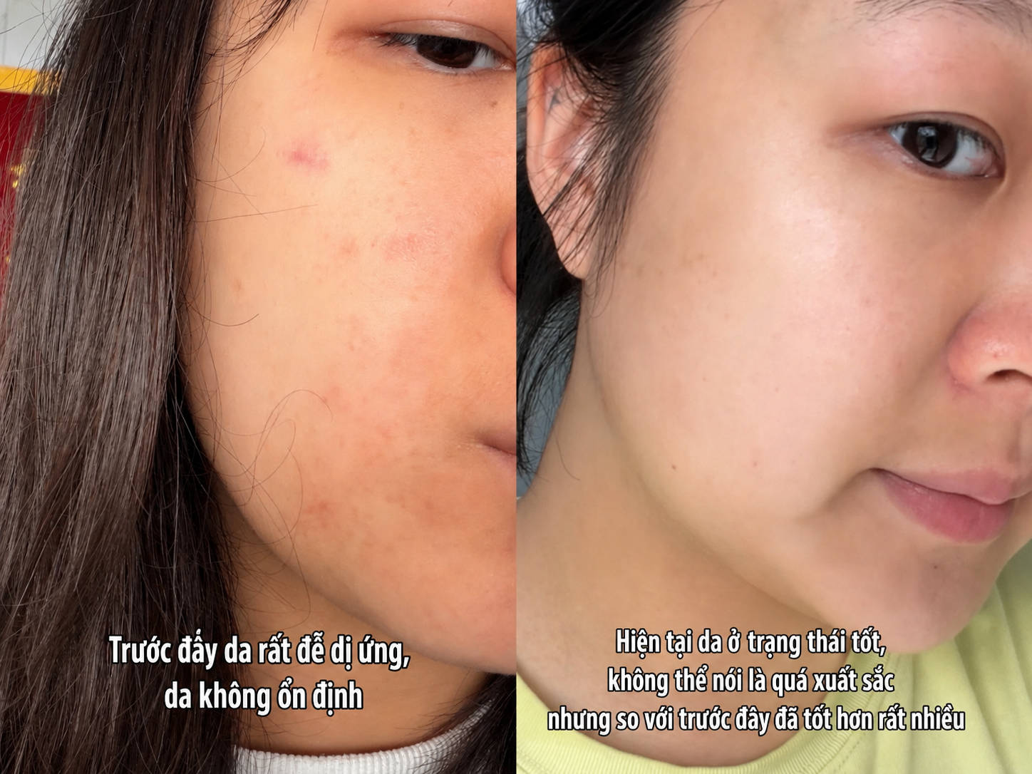 Kh&ocirc;ng gi&uacute;p đẹp sau một đ&ecirc;m, nhưng th&oacute;i quen n&agrave;y khiến l&agrave;n da của t&ocirc;i ổn định hơn từng ng&agrave;y - Ảnh 3.