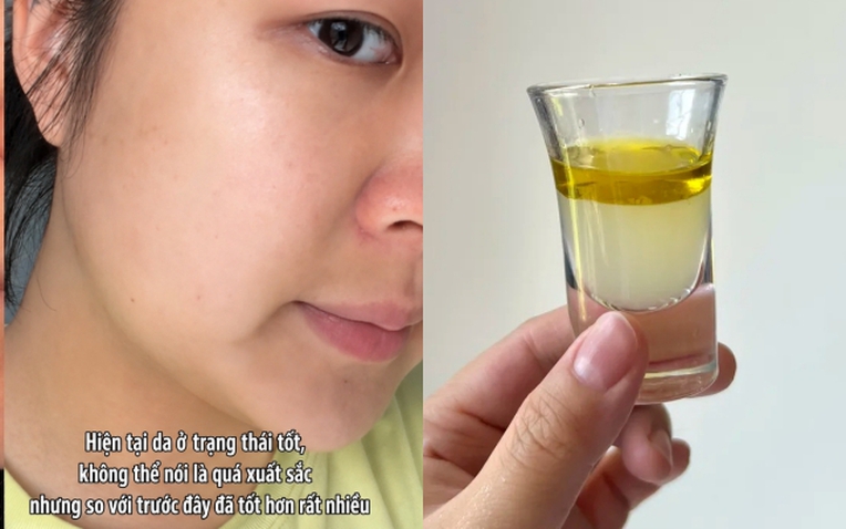 Kh&ocirc;ng gi&uacute;p đẹp sau một đ&ecirc;m, nhưng th&oacute;i quen n&agrave;y khiến l&agrave;n da của t&ocirc;i ổn định hơn từng ng&agrave;y - Ảnh 1.