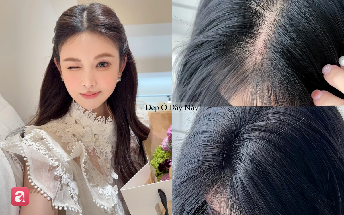 5 lọ dưỡng serum t&oacute;c 
