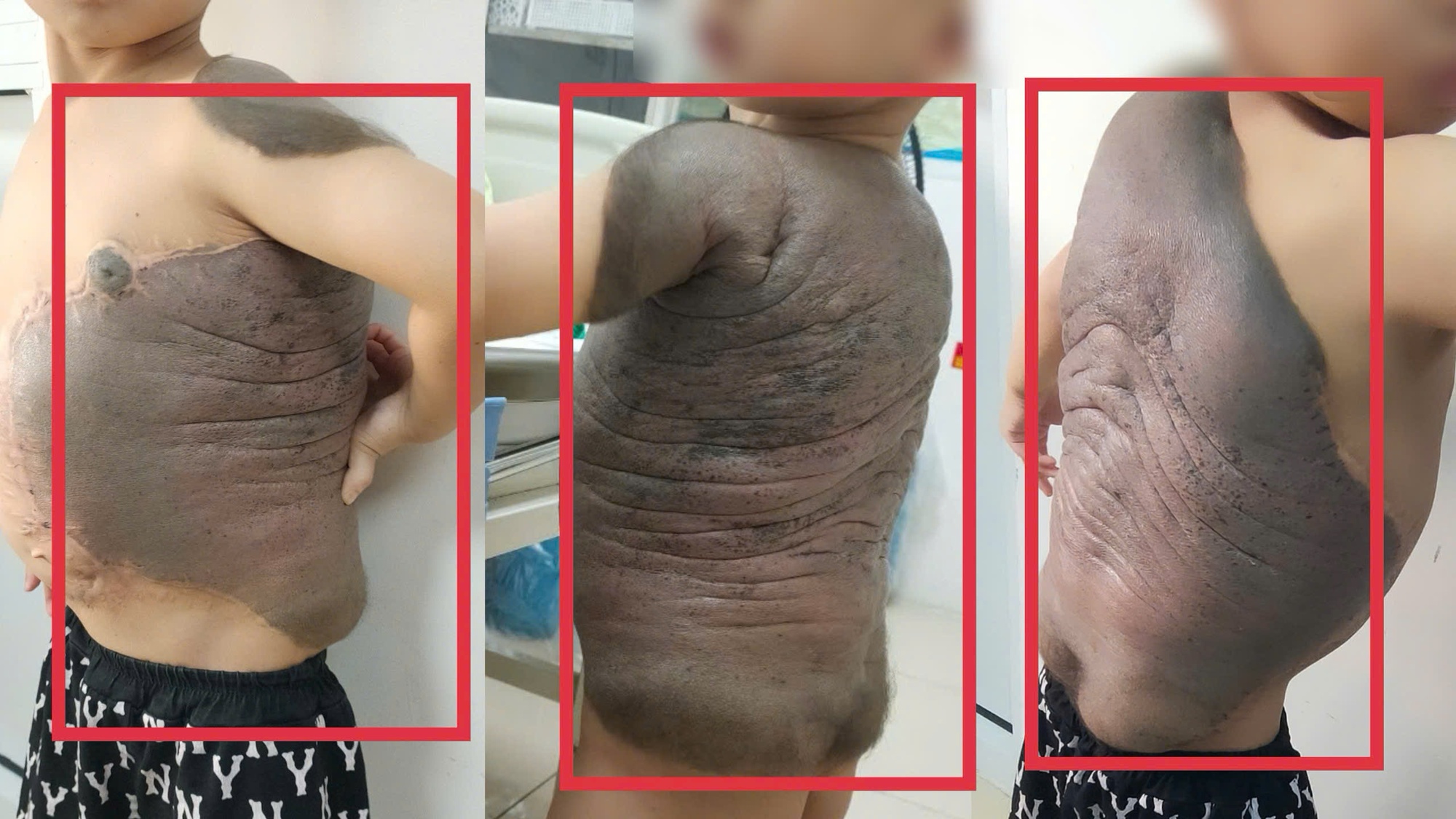 Cảnh b&aacute;o: 5 thay đổi ở ch&acirc;n rất c&oacute; thể l&agrave; do đủ loại ung thư 