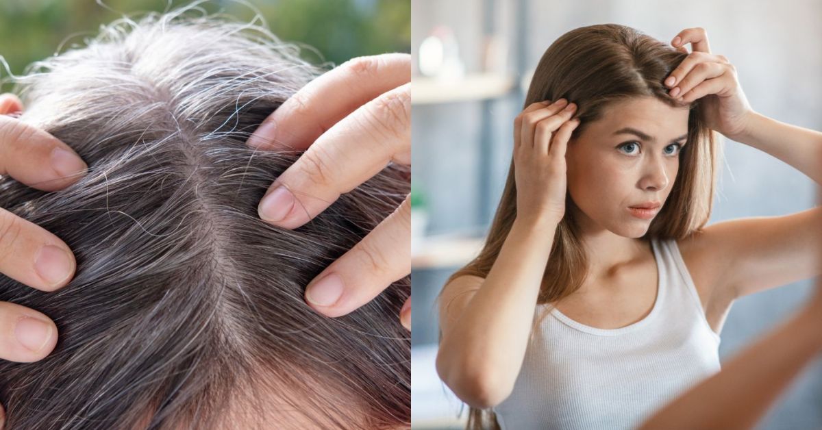 Tóc trắng xuất hiện ngày càng nhiều? Đừng chỉ nghĩ là do tuổi tác, tóc trắng xuất hiện ở 3 vùng này có thể là cơ thể đang