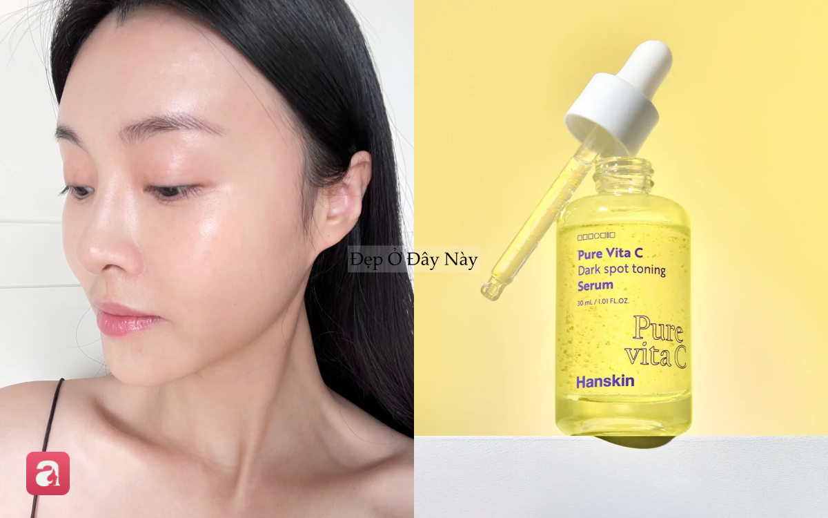 5 Th&agrave;nh phần chống l&atilde;o h&oacute;a thay thế retinol an to&agrave;n cho da nhạy cảm năm 20265 